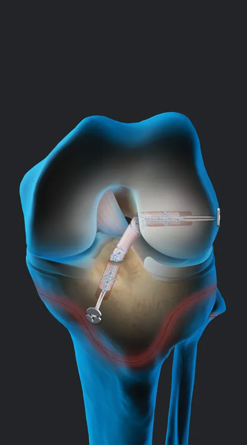 Yalangoch Larisa Guzeeva.