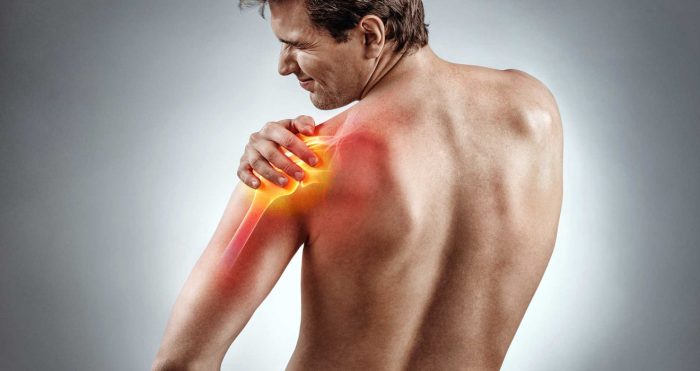 Sinsi ilerleyen omuz ağrısı; Donuk Omuz