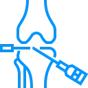 Diz Osteoartritinde Eklem İçi Eksozom Uygulaması: Yenilikçi Bir Tedavi Seçeneği