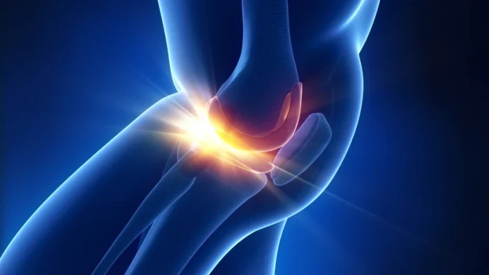 Eklemlerin kronik ağrısı: Osteoartirit