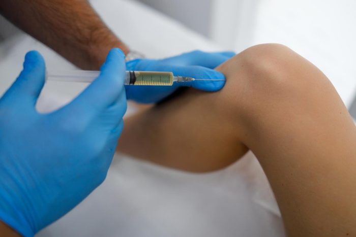 Diz Osteoartritinde Eklem İçi Eksozom Uygulaması: Yenilikçi Bir Tedavi Seçeneği